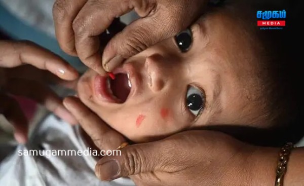 தடுப்பூசி போடப்பட்ட குழந்தைகளுக்கு கூட அம்மை நோய் தாக்கும் அபாயம்! samugammedia 